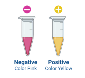 Visual detection